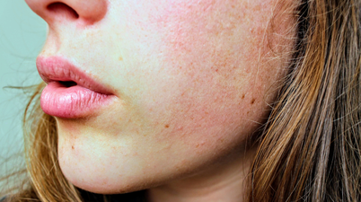 ‘A little goes a long way’ – The moisturiser people with dry skin won’t regret buying this winter