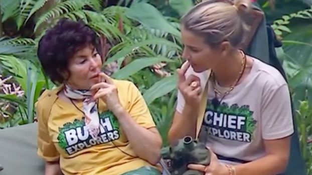 Vogue Williams reveals the cosmetic work she's had done before filming I'm A Celeb